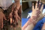 is brown henna safe, fashion and beauty, henna tattoo cause aussie woman to almost lose her hand, Phenyl