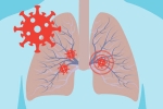 Covid-19, cytokine storm syndrome, how does covid 19 affect different parts of the body, Older people