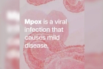 mpox break down, mpox in Pakistan, mpox emergency again, Tamil nadu