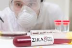 Zika screening, FDA, fda expands zika screening to all us blood centers, Zika virus